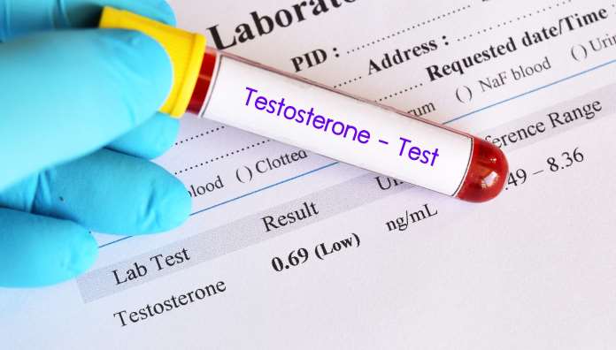 esami del sangue per misurare il testosterone